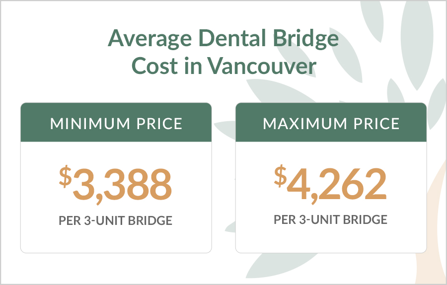 Average Dental Bridge Cost in Vancouver